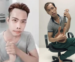 "Thảm họa showbiz" Tùng Sơn đại phẫu thuật, thay đổi hoàn toàn dung mạo