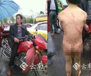 Bé trai bị bố đánh đập, bắt cởi quần áo chạy theo xe máy dưới mưa