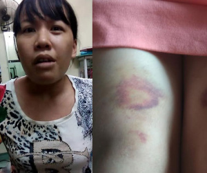 Chủ cửa hàng gội đầu đánh khách chấn thương sọ não