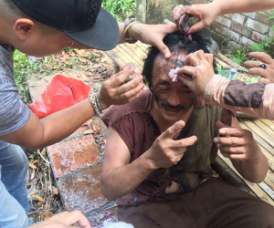 Diễn sung, Giang còi bị đồng nghiệp đánh chảy máu mặt