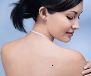 Những vị trí nốt ruồi trên lưng cực quý hiếm, nhiều LỘC tuyệt đối không được tẩy xóa