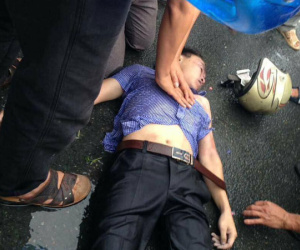 Vĩnh Phúc: Đang đi giữa đường, nam thanh niên bị sét đánh trúng mặt gây bất tỉnh