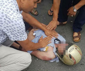 Nam thanh niên bị sét đánh trúng mặt khi đang đi đường: Tiên lượng xấu
