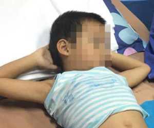Sùi mào gà, căn bệnh chủ yếu lây qua tình dục, đã truyền sang trẻ em thế nào?