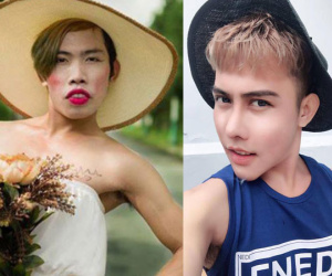 Không thể nhận ra Tùng Sơn sau khi phẫu thuật "đại tu nhan sắc"!