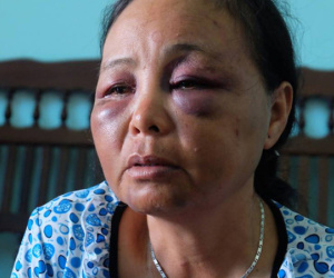 Người phụ nữ bán tăm bị đánh oan vì tưởng bắt cóc trẻ em: "Chỉ vì lời 1 cô gái mà họ lao vào đấm, đá túi bụi chúng tôi"