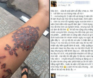 Xóa hình xăm vì khó tìm việc, chàng trai khuyên bạn trẻ "nghĩ kĩ rồi mới xăm"