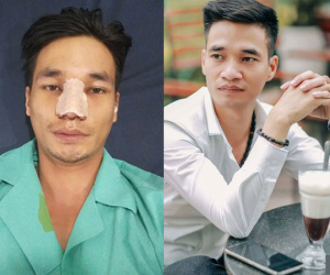 Lệ Rơi lộ hình ảnh ngỡ ngàng sau ca đại phẫu nhan sắc