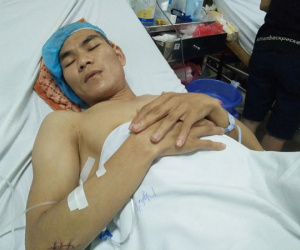 Nam ca sĩ bị chém 11 nhát dao vì tiểu bậy