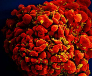 Ca nhiễm HIV thứ 3 trên thế giới được chữa khỏi