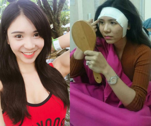 Thực hư chuyện Thanh Bi "đập đi xây lại" toàn bộ cơ thể gây sốc