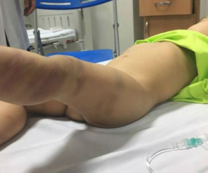 Hà Nội: Khởi tố vụ bé trai bị đánh đập, bỏ lại bệnh viện