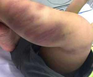 Bà ngoại bé trai 1 tuổi bị bạo hành: Sao họ độc ác thế?