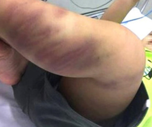 Vụ bé trai 1 tuổi bị bạo hành nghiêm trọng: "Người tốt" để lại địa chỉ "ma"