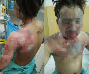 Giận vợ, chồng tưới xăng dọa đốt nhà, lửa bùng cháy gây bỏng cho cả đứa con mới hơn 2 tuổi