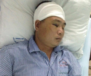 Hải Phòng: Hé lộ nguyên nhân nhóm côn đồ truy sát người dân trọng thương