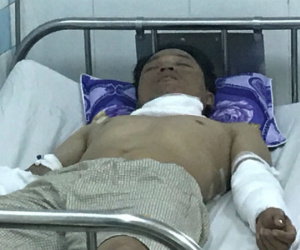 Ảnh minh họa