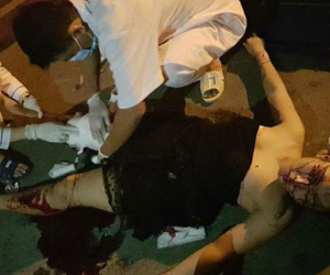 Xe máy kẹp 5 đi đêm lao vào dải phân cách, cô gái mặc váy ngắn rách toác chân