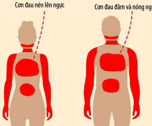 8 dấu hiệu có thể cảnh báo sớm một tháng trước cơn đau tim