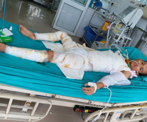 Hơn 20 ngày giành lại sự sống của chàng trai bị cháy ở xưởng bánh kẹo khiến 8 người tử vong