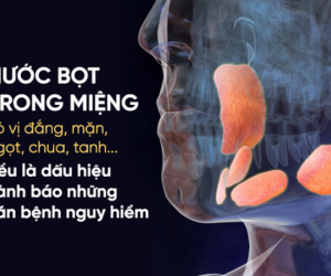 Ngủ dậy miệng có 6 vị này: Coi chừng nội tạng đang gặp nguy hiểm!