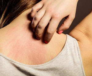 7 dấu hiệu cảnh báo ung thư mà 90% mọi người thường bỏ qua