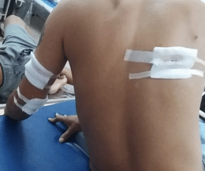Thanh Hóa: 3 thanh niên bị nhóm người bịt mặt bắn trọng thương