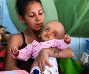 Bệnh tật trong đói nghèo là tận cùng tai họa của người Venezuela