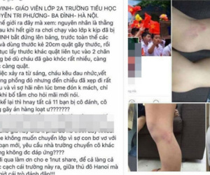 Cô giáo trường Nguyễn Tri Phương đánh học sinh lớp 2 bầm tím