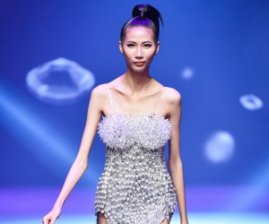 Cao Ngân gầy trơ xương vì từng bị tai nạn dập phổi