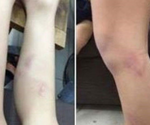 Hà Nội: Tạm đình chỉ cô giáo đánh học sinh do vào lớp chậm
