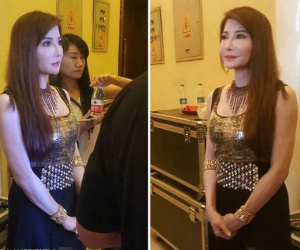 Sao "Bản lĩnh Kỷ Hiểu Lam" cằm nhọn, mũi xộc xệch vì "dao kéo"