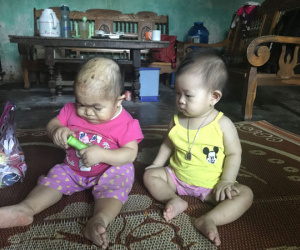 Kỳ lạ người phụ nữ 27 tuổi mang hình hài "trẻ lên 2" ở Thái Nguyên
