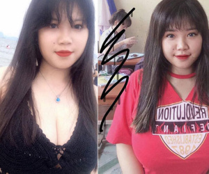 Nỗi khổ của cô gái Hải Dương mang vòng 1 hơn 110cm