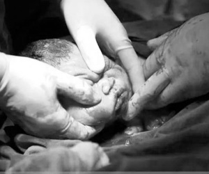 Khi đau đẻ ai cũng đòi mổ nhưng mẹ có biết một ca sinh mổ đau đớn thế nào không?