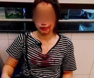 Công an TP Vinh: Sĩ quan công an có mặt nhưng không đánh cô gái