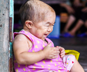 Cô gái gần 30 vẫn mang hình hài của đứa trẻ 2 tuổi: Lủi thủi trong nhà cả đời, không có bạn cùng chơi