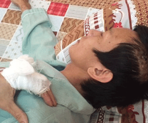 Đang ăn đêm, chủ cửa hàng massage bị côn đồ bịt mặt chém xối xả