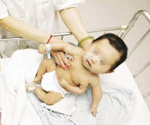 Xót xa mẹ hiếm muộn chờ đợi bao năm cuối cùng con sinh ra lại dị tật 3 tay