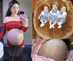 Mẹ 9x kể về hành trình mang thai ba: Quyết định giữ lại cả ba con dù bác sĩ nào cũng khuyên bỏ bớt