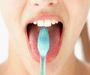 Chứng lưỡi lông đen - Những điều cần biết
