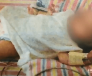 Kết án đôi vợ chồng vì nuôi con theo chế độ thuần chay: 20 tháng tuổi chỉ nặng 4,9kg, suy dinh dưỡng trầm trọng