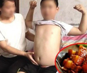 Bố mẹ tự hào vì con 11 tuổi lớn vù vù nhưng 1 ngày bỗng dưng đau ngực, bác sĩ khẳng định phát triển sớm vì món ngon mẹ ép ăn hàng ngày