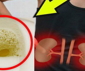 Cẩn thận với những triệu chứng kéo dài đang ngầm cảnh báo nguy cơ suy thận sắp xảy ra