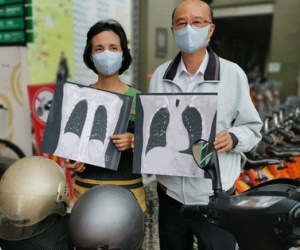 40 năm chưa từng đeo khẩu trang khi ra đường, 2 vợ chồng đau đớn khi cùng mắc loại ung thư này