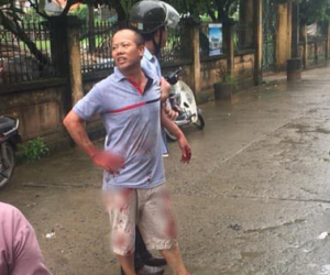 Ảnh minh họa