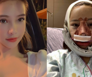 Lưu Đê Ly khoe trải qua 6 ca phẫu thuật ở Hàn để 'đập mặt làm lại', đẹp hay không chưa bàn chỉ biết là quá dũng cảm rồi!