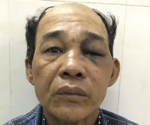 Ảnh minh họa
