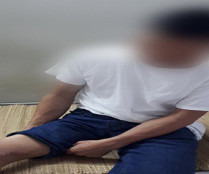 Bệnh Whitmore 'ăn thịt người' đột ngột tấn công nhiều người: Ghi nhận thêm 1 trường hợp mắc bệnh tại bệnh viện Trung Ương Thái Nguyên