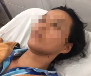 Vụ chồng đánh vợ, dìm xuống hồ bơi trước mặt con nhỏ: Nạn nhân không nhớ nổi số lần bị bạo hành